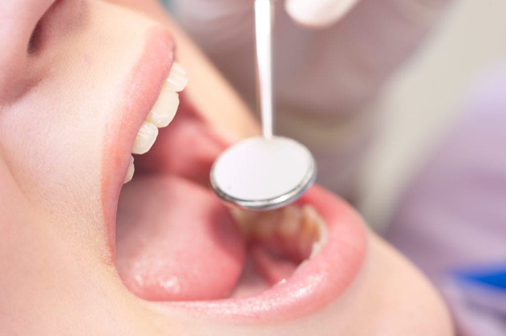 dental-checkup_87604477